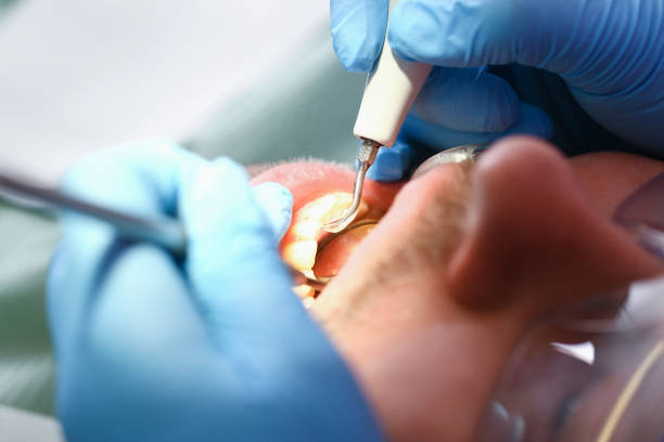 Best Emergency Treatment for Toothache in Regency At Monroe, NJ